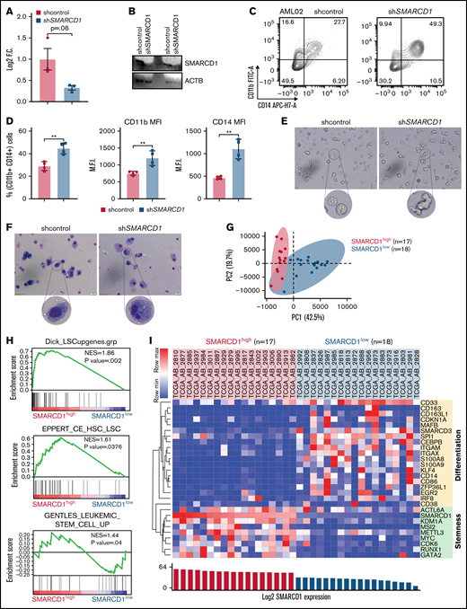 Patients with AML with high SMARCD1 levels harbor transcriptomic signatures of leukemic stem cells and show poor prognosis. (A-E) SMARCD1 regulates myeloid differentiation in patient-derived CD34+ HSPCs. (A) Log2 fold change of SMARCD1 expression calculated with respect to shcontrol cells using RT-PCR and (B) Western blot showing reduction in SMARCD1 levels on lentiviral transduction and after 96 hours of puromycin selection. ACTB mRNA was used for normalizing SMARCD1 expression in RT-PCR, and ACTB was used as the protein loading control. (C-D) Contour plots showing percentage of double-positive CD11b and CD14 cells and MFI plots of shcontrol and shSMARCD1-transduced CD34+ HSPCs. (E-F) Bright field images of shcontrol and shSMARCD1 cells in culture (E) and May Grünwald Giemsa (F) staining showing nucleo-cytoplasmic morphologic features. Error bars indicate means ± standard deviation. *P = .05; **P = .005: 2-tailed Student t test. (F-K) Transcriptomic signatures of AML patients with high and low SMARCD1 gene expression. Patients with AML from the TCGA cohort were stratified in the top and bottom 10th percentile as SMARCD1high and SMARCD1low groups. (F) Principal component analysis plots of SMARCD1high and SMARCD1low groups depicting clear segregation of the samples from TCGA. (G) Gene set enrichment analysis of transcriptomic signatures in SMARCD1high and SMARCD1low groups from AML TCGA cohorts. Normalized enrichment score (NES). (H) Z-score–normalized heat map representation of bona fide differentiation- and stemness-related genes in SMARCD1high and SMARCD1low groups from AML TCGA cohort. (I) Relative log2 fold change of indicated genes in CD34+ AML cells compared with that in the CD34− population. Error bars indicate means ± standard deviation; 2-tailed Student t test. (K) Correlation analysis showing positive correlation of AML patients in TCGA cohort with different levels of blast percentage (i) and negative correlation of SMARCD1 expression with percentage of monocytes present in peripheral blood of patients with AML in the BEAT AML cohort (ii).
