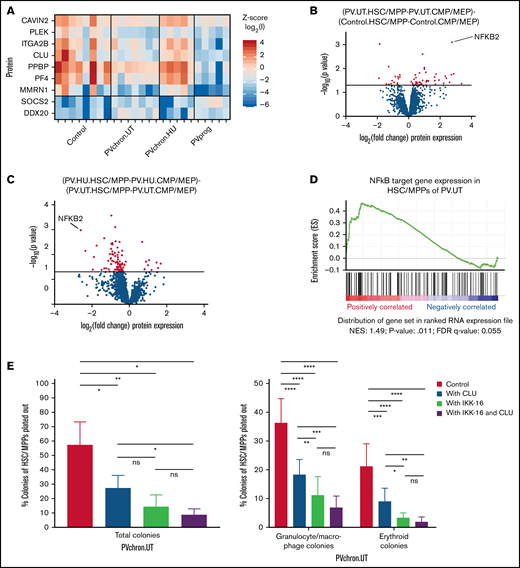 Roles of CLU and the NF-κB pathway for HSC/MPPs of patients with untreated PV. (A) PV stem/progenitor cell protein signature. (B) Volcano plot of protein intensity fold changes and P values comparing HSC/MPP-specific findings of patients with untreated PV (PV.UT.HSC/MPP vs PV.UT.CMP/MEP) against HSC/MPP-specific findings of controls (Control.HSC/MPP vs Control.CMP/MEP), and (C) HSC/MPP-specific findings of PV patients with HU therapy (PV.HU.HSC/MPP vs PV.HU.CMP/MEP) against HSC/MPP-specific findings of patients with untreated PV (PV.UT.HSC/MPP vs PV.UT.CMP/MEP). (D) GSEA plot for NF-κB signaling in HSC/MPPs of patients with untreated PV compared with controls (PV.UT.HSC/MPP vs Control.HSC/MPP). The normalized enrichment score and significance values are provided. (E) Methylcellulose colony assay: Colony growth from FACS-isolated HSC/MPPs of patients with untreated chronic PV (PVchron.UT) was evaluated in the presence or absence of CLU, IKK-16, or their combination. Percentages of colonies relative to the total cell numbers plated are plotted. Error bars represent standard deviations. One-way (total colonies) and 2-way (granulocyte/macrophage and erythroid colonies) analysis of variance testing was applied using Tukey (1-way) and Dunnett (2-way) correction for multiple testing. *Adjusted P < .05; **adjusted P < .01; ***adjusted P < .001; ****adjusted P < .0001.