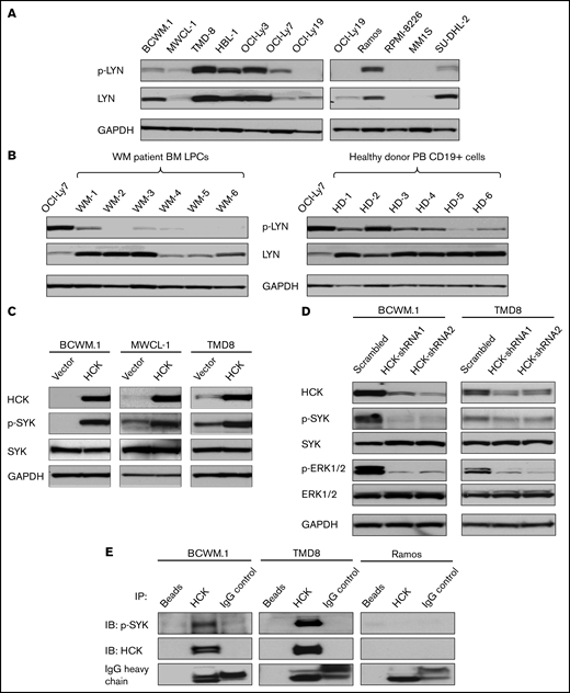 The SFK HCK activates SYK in MYD88 mutated lymphomas cells. (A) Expression of p-LYNTyr396 levels by western blot analysis in MYD88L265P BCWM.1, MWCL-1 WM cells, TMD8, HBL-1, OCI-Ly3; MYD88Ser222Arg SU-DHL-2 ABC DLBCL cells; and MYD88WT OCI-Ly7, OCI-Ly19 GCB DLBCL cells, Ramos Burkitt lymphoma cells, RPMI-8226, and MM.1S multiple myeloma cells. The expression levels of total LYN in these cells as well as protein loading control glyceraldehyde-3-phosphate dehydrogenase (GAPDH) are also shown. (B) p-LYNTyr396 levels by western blot analysis in CD19-selected bone marrow LPC from 6 MYD88Leu265Pro patients with WM of whom WM1 was also CXCR4Mut and WM2-6 was CXCR4WT, and CD19-selected peripheral blood (PB) B cells from 6 healthy donors; lysates from OCI-Ly7 GCB DLBCL cells were used for p-LYN and protein loading control. The expression of total LYN is also shown. (C) Expression of p-SYKTyr525/Tyr526 levels by western blot analysis in vector-only, HCKWT or HCKThr333Met transduced BCWM.1, MWCL-1 WM cells, and TMD8 ABC DLBCL cells. Expression levels of total HCK, SYK in these cells as well as GAPDH for protein loading control are shown. (D) Changes in p-SYKY525/526 and p-ERK1/2Thr202/Tyr204 levels following HCK knockdown with doxycycline inducible shRNA1 and shRNA2 or scrambled control vector in BCWM.1 WM and TMD8 ABC DLBCL cells. p-SYKTyr525/Tyr526 and p-ERK1/2Thr202/Tyr204 levels were detected at day 9 following 1.0 µg/mL doxycycline induction. p-ERK1/2Thr202/Tyr204, a known downstream signaling component of HCK, served as a positive control for these experiments.4 Expression levels of total HCK, SYK, and ERK1/2 as well as GAPDH for protein loading control are also shown. (E) p-SYKY525/526 protein levels by western blot analysis following a co-IP with HCK protein in MYD88Mut BCWM.1 and TMD8 cells, and MYD88WT Ramos cell lysates. Magnetic beads only and rabbit IgG were used as co-IP experimental controls. HCK total protein was also shown as an indication of the co-IP efficiency in these cells. IgG heavy chain was shown as an indication of the quantity of antibodies used in the co-IP experiments. Above experiments were performed at least twice with representative results shown. BM, bone marrow.