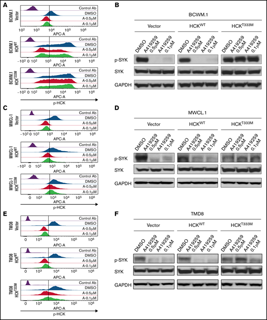 SYK activation is driven by the SFK HCK in MYD88 mutated lymphoma cells. (A) Relative p-HCKTyr410 levels by PhosFlow analysis following the treatment with dimethyl sulfoxide (DMSO) or the HCK inhibitor A419259 at the indicated concentrations for 1.0 hour in vector-only, HCKWT, or HCKThr333Met transduced BCWM.1 cells. (B) Relative p-SYKY525/526 levels by PhosFlow analysis following treatment with DMSO or A419259 at indicated concentrations for 1.0 hour in vector-only, HCKWT, or HCKThr333Met transduced BCWM.1 cells. (C) Relative p-HCKTyr410 levels by PhosFlow analysis following the treatment with DMSO or A419259 at indicated concentrations for 1.0 hour in vector-only, HCKWT, or HCKThr333Met transduced MWCL-1 cells. (D) Changes in p-SYKTyr525/Tyr526 levels following the treatment with DMSO or A419259 at indicated concentrations for 1.0 hour in vector only, HCKWT, or HCKThr333Met transduced MWCL-1 cells. The expression levels of total SYK in these cells as well as protein loading control GAPDH are also shown. (E) Relative p-HCKTyr410 levels by PhosFlow analysis following the treatment with DMSO or A419259 at indicated concentrations for 1.0 hour in vector only, HCKWT, or HCKThr333Met transduced TMD8 cells. (F) Changes in p-SYKTyr525/Tyr526 levels following the treatment with DMSO or A419259 at indicated concentrations for 1.0 hour in vector-only, HCKWT, or HCKThr333Met transduced TMD8 cells. The expression levels of total SYK in these cells as well as protein loading control GAPDH are also shown. (G) p-HCKTyr410 levels and p-SYKTyr525/Tyr526 levels by PhosFlow analysis following the treatment with DMSO or A419259 at the indicated concentrations for 1.0 hour in CD20+ gated patient with WM bone marrow lymphoplasmacytic cells. Above experiments were performed at least twice with representative results shown. Ab, antibody.