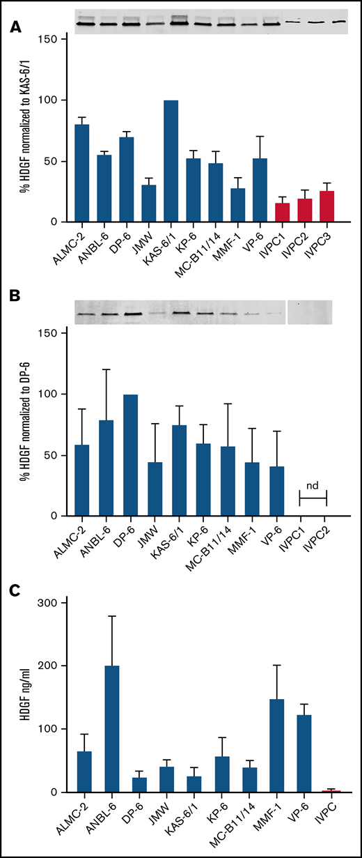HDGF is present in HMCL extracts, HMCL EVs, and HMCL-conditioned media. (A) Top panel, Western blots demonstrate HMCLs express higher levels of HDGF than IVPCs; bottom panel, quantification of HDGF levels of expression normalized to total protein in each sample. Average of 3 experiments normalized to levels in KAS-6/1 (HMCL expressing the highest amount of HDGF). (B) Top panel, Western blots demonstrate EVs derived from HMCLs express varying amounts of HDGF, whereas EVs from IVPCs do not have detectable levels. Bottom panel, quantification of HDGF levels of expression normalized to total protein in each sample. Average of 3 experiments normalized to levels in DP-6 (HMCL EVs expressing the highest amount of HDGF). Nd, not detectable. (C) Levels of HDGF in HMCL-conditioned media measured by ELISA show that HMCLs secrete between 10- to 100-fold more HDGF than IVPCs. HMCL samples were tested in triplicate (except JMW and VP-6, which are duplicates); IVPC values reflect an average of 5 independent determinations. Means ± SD are shown.