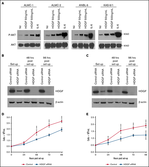 Autocrine effects of HDGF on HMCLs. (A) HDGF induces AKT phosphorylation in ALMC-1, ALMC-2, ANBL-6, and KAS-6/1 cells. Serum-starved cells were stimulated with IL-6 as a positive control and 50 ng/mL or 500 ng/mL HDGF for 1 hour. Top panels show the phosphorylation of AKT upon stimulation with HDGF; bottom panels show total AKT levels in each lane. siRNA knockdown of ALMC-1 (B,D) and ANBL-6 (C,E) results in reduced HDGF expression (B,C) and impaired proliferation (D,E). Results shown are representative of triplicate determinations. ***P < .001. Means ± SD are shown.