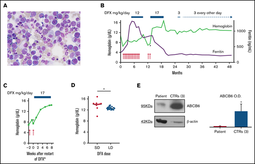 Robust and dose-dependent erythroid response of hyporegenerative anemia during DFX treatment. (A) BM morphology of the aspiration specimen obtained on initial consultation shows erythroid hyperplasia and impaired erythroid maturation without evidence of MDS or other malignancies (original magnification ×40). (B) Overview of the kinetics of Hb (green line) and ferritin (purple line) levels, transfusion requirements, and DFX dosing. Each red arrow denotes the transfusion of 1RBC unit. Within the first 8 months, a total of 29 RBC units were transfused. Periods of DFX treatment are indicated at the top. Changes in line thickness reflect changes in drug dose. The asterisk marks the start of the DFX rechallenge, a closer view of which is provided in panel C. Ferritin levels were already increased on initial presentation and continued to rise during transfusion therapy until DFX treatment was initiated. Subsequently, ferritin levels declined and stabilized at slightly elevated levels of >200 ng/mL. (C) Rapid increase in Hb levels within a few weeks after restart of DFX treatment. The corresponding time point in panel B is indicated by an asterisk. Of note, CRP was elevated to 57.9 mg/L at week 0 and normalized to <3 mg/L (without any antibiotics) at week +7. (D) Dose-dependent distribution of Hb levels during DFX treatment. Standard-dose (SD) DFX was administered between months 13 and 19, and low-dose (LD) DFX between months 25 and 49 after initial presentation. Hb levels were significantly higher during SD (17 mg/kg/d) than during LD (3 mg/kg/d or even every other day) DFX treatment (median Hb of 14.1 g/dL vs 12.6 g/dL; P = .02 by unpaired t test). Horizontal lines represent the median; asterisk indicates statistical significance. (E) (Left) Representative immunoblot of ABCB6 protein in the membrane of RBC lysate of the proband and a pool of 3 healthy controls. β-actin is the loading control. (Right) Quantification by densitometric analysis from 3 separate western blots with similar results. Data are means ± standard deviation (*P < .05). OD, optical density.
