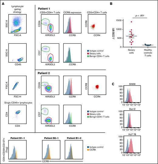 CCR8 is overexpressed at the cell surface of CTCL peripheral blood tumor cells and is involved in Sézary cell activation and proliferation. Flow cytometric analyses of CCR8 expression by peripheral blood Sézary cells, regulatory T cells, healthy controls T cells, and T-cell lymphoma cell lines. (A) Gating strategy of peripheral blood Sézary cells (left panels) and mean fluorescence intensity of CCR8 expression in Sézary cells (vs control isotype) of 2 Sézary patients (medium panels). CCR8/CCR4 coexpression by Sézary cells is shown on the right panels. CCR8 was not significantly expressed by peripheral blood CD4+CD25hiCD127lo Tregs from Sézary patients (lower histograms). (B) CCR8 δ mean fluorescence intensity (CCR8 mAb, control isotype) in fresh Sézary cells from Sézary patients compared with healthy controls T cells. (C) Expression of CCR8 by SNK6, DERL-2, and HuT78 cell lines. (D) CCR8 stimulation by its ligands CCL18 (upper blots) and CCL1 (lower blots) induces Sézary cell activation. Freshly isolated Sézary cells were cultured for 15 or 30 minutes in medium alone or in the presence of IL-2 (100 IU/mL), CCL1 (10 ng/mL), CCL-18 (300 ng/mL), IL-2/CCL1, or IL-2/CCL18. The cells were lysed in NP40 (the content of the nuclei not visible), and expression of pErk1/2 was analyzed by western blot. (E) CCR8 stimulation by its CCL1 ligand induces Sézary cell proliferation. Fresh PBMC were incubated in CFSE and cultured over 96 hours in IL-2 (100 IU/mL), CCL-1 (10 ng/mL), or IL-2/CCL1 and the percentage of CFSElo cells calculated among live KIR3DL2+ Sézary cells. (F) CCR8 expression in freshly isolated healthy controls peripheral blood mononuclear cells before and after 3 days of in vitro CD3/28 activation. CFSE, carboxyfluorescein diacetate succinimidyl ester; mAb, monoclonal antibody; PBMC, peripheral blood mononuclear cell.