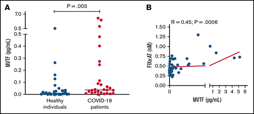 MVTF activity is increased in patients with COVID-19. (A) Levels of TF activity in microvesicles isolated from healthy individuals (blue circles) and patients with coronavirus disease (red circles). (B) Correlation between FIXa:AT complex and MVTF.