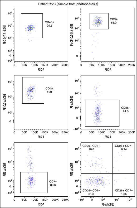 High efficiency purification of SS cells from patient photopheresis. Representative FC analysis of a blood sample obtained from the photopheresis of the indicated SS patient. Noteworthy is the high prevalence of malignant CD4+, CD26–, and CD7– lymphocytes.