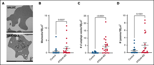Ultrastructural analysis of ATG4A KD reticulocytes. (A) Transmission electron micrograph of day 18 reticulocytes from control and ATG4A KD cultures. Mitochondria are marked with arrows. Quantification of mitochondria (B), autophagic vesicles (C), and lysosomes (D). Analysis was performed on 2-dimensional sections of at least 18 reticulocytes from each group. Data shown reflect 2 hairpins per group and are plotted as mean ± SEM of a single donor. Data were analyzed using the Mann-Whitney test.