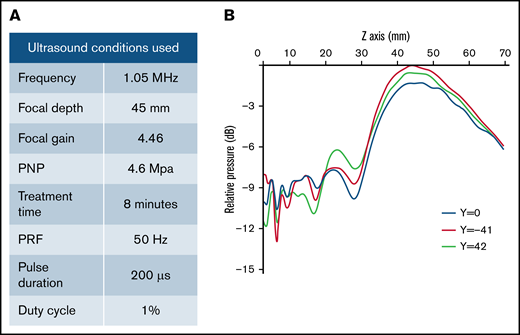 Therapeutic ultrasound design and parameters used. (A) Outline of specific ultrasound conditions used in this experiment. (B) Conditions were chosen on the basis of previous experiments that optimized gene transfer in pigs. H114H is a geometrically focused transducer with the highest intensity at 45 mm (Z = 45 mm) from the face of the transducer (Z = 0 mm), shown by a map of relative pressure measured in decibels (dB) using a hydrophone. Measurements were taken at 3 Y locations across the length of the transducer where y = −41 is the left side and y = 42 is the right side relative to the center (y = 0) of the transducer.