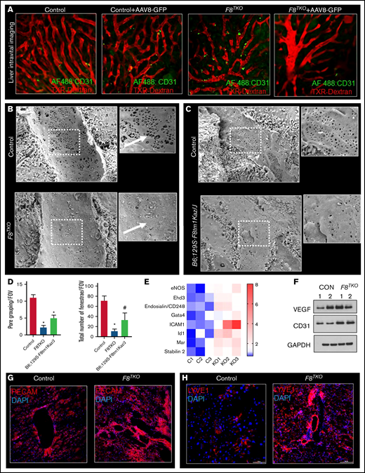 F8TKO mice show defenestrated vascularized LSEC with decreased permeability. (A) Liver intravital imaging of control and F8TKO liver at baseline and 15 days post–AAV8-GFP administration injected with TXR-dextran and AF488-anti-CD31. (B) SEM images show LSEC fenestrae are significantly less in a representative F8TKO mouse as compared with a control mouse. (C) SEM images show LSEC fenestrae are significantly less in a representative B6; 129S-F8tm1Kaz/J mouse as compared with a control mouse. (D) Quantification of pore grouping and total number of fenestrae per field of view in the liver of control B6; 129S-F8tm1Kaz/J and F8TKO mice. (E) Heatmap consisting of qRT-PCR analysis of endothelial-specific genes (CD31, VEGF, ICAM1, stabilin2, ID1, Gata4, and Ehd3) in control and F8TKO mice liver. (F) Western blot analysis of VEGF and CD31 in control and F8TKO mice at baseline. Immunofluorescence for PECAM (G) and LYVE-1 (H) showed an increased accumulation in F8TKO mouse liver tissue at baseline, which was not seen in age-matched control liver. All control mice used were unaffected littermate heterozygoes mice.