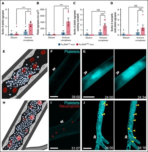 Platelet aggregation and trapped neutrophils in response to immune complexes in FcγRIIATGN mice. (A) The number of platelet aggregates observed in response to immune complexes or diluent in both FcγRIIAnull mice (dark blue) and FcγRIIATGN mice (pink) (n = 5-6 mice for each condition). (B) Mean platelet aggregate area in response to immune complexes or diluent in both FcγRIIAnull mice (dark blue) and FcγRIIATGN mice (pink) (n = 5-6 mice for each condition). (C) Mean number of platelet aggregates containing at least 1 neutrophil in both FcγRIIAnull mice (dark blue) and FcγRIIATGN mice (pink) (n = 5-6 mice for each condition). ND, statistical test not defined because of the absence of platelet aggregates in 1 of the groups of mice. (D) Mean number of neutrophils inside platelet aggregates in both FcγRIIAnull mice (dark blue) and FcγRIIATGN mice (pink) (n = 5-6 mice for each condition). ND, statistical test not defined because of the absence of platelet aggregates in 1 of the groups of mice. (E) Schematic representation of thrombotic events observed with a high-speed widefield fluorescence microscope in the brain of FcγRIIATGN mice injected intravenously with immune complexes. (F) Absence of platelet aggregates in FcγRIIATGN::Ly6gCre+/−::Rosa26-TdT+/−::CD41-YFP+/− mice injected with diluent (n = 6 mice). (G) Formation of platelet aggregates (cyan) in FcγRIIATGN::Ly6gCre+/−::Rosa26-TdT+/−::CD41-YFP+/− mice injected with immune complexes leads to obstruction of blood vessels (n = 6 mice). (H) Schematic representation of neutrophils trapped in platelet aggregates observed in the brain of FcγRIIATGN mice injected intravenously with immune complexes. (I) Platelets (cyan) and neutrophils (red) circulating in the brain of FcγRIIATGN::Ly6gCre+/−::Rosa26-TdT+/−::CD41-YFP+/− mice injected with diluent. (J) Platelet aggregates (cyan) can trap neutrophils (red, yellow arrows) (n = 5 mice of 6). Bars show mean ± SEM. Two-way ANOVA with repeated measures followed by a post-hoc Holm-Bonferroni test (A-B). *P < .05; **P < .01; ***P ≤ .001. Bars represent 50 µm. The direction of blood flow is indicated with double white arrowheads. Time following the injection of immune complexes is indicated in the inferior right corner (00:00 = minutes:seconds).
