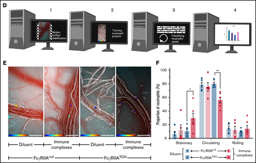 Platelet and neutrophil interactions observed in response to immune complexes. (A-C) Schematic representations (left panels) of different cellular interactions recorded in the brain of both FcγRIIATGN and FcγRIIAnull (Ly6gCre+/−::Rosa26-TdT+/−::CD41-YFP+/−) mice injected with immune complexes and observed with a high-speed widefield fluorescence microscope (right panels). (A) Platelet (cyan) and neutrophil (red) interactions can be associated with partial adhesion (rolling) of neutrophils (neutrophil 2) on blood vessels. (B) “Kiss and fly interaction,” in which an adhered neutrophil (red) briefly interacts with circulating platelets (cyan). (C) Neutrophils (red) adhere to blood vessels in response to immune complexes. Circulating platelets (cyan) interact (white arrows) with both immobilized and rolling neutrophils (yellow arrows). Bars represent 50 µm. The direction of blood flow is indicated with double white arrow heads. Time following the injection of immune complexes is indicated in the inferior right corner (00:00 = minutes:seconds or 00:00:00 = hours:minutes:seconds). Rolling and adhered neutrophils are indicated with yellow arrows, and neutrophil–platelet interactions are indicated with white arrows. (D) Schematic representation of the computer analysis used to track neutrophil trajectories and speed: (1) Image stabilization using Mathworks Matlab 2018b; (2) Neutrophil tracking performed with Bitplane Imaris 7.6 software; (3-4) Automated classification of trajectories using a program in Mathworks Matlab 2018b. (E) Recorded neutrophil trajectories (white lines) in the blood vessels of FcγRIIAnull and FcγRIIATGN mice injected with diluent or immune complexes (Bitplane Imaris 7.6 software). Neutrophils are color coded according to their speed: from dark blue (0 µm/sec) to dark red (4000 µm/sec). Bars represent 100 µm. (F) Number of neutrophils classified according to their speed: “stationary” for neutrophils moving in an area of <10 µm diameter; “rolling” when neutrophils circulate at ≤200 µm/s over 10 µm distance or more; and “circulating” in other cases. Bars represent mean ± SEM. Two-way ANOVA with repeated measures followed by a post-hoc Holm-Bonferroni test (D). *P < .05; **P < .01.