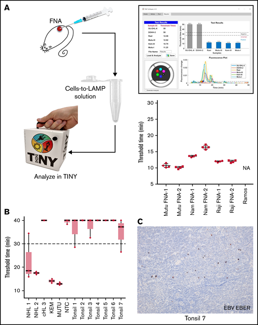 EBV cells-to-LAMP assay is compatible with a point-of-care approach. (A) FNA samples obtained from EBV+ cell line xenografts in mice were tested using cells-to-LAMP followed by analysis with TINY (left), with representative cells-to-LAMP results output by TINY software of EBV+ and EBV- cell lines shown (top right). The blue bars in this image indicate the 4 EBV+ cell lines that amplified before the threshold time. Four independent aspirates were taken from each of 2 tumors per cell line (bottom right). NA denotes that the negative control cell line, Ramos, was not amplifiable. (B) Fresh tonsil specimens were used to perform an ex vivo FNA with cells-to-LAMP followed by TINY. Tissue specimens from 3 EBV+ lymphoma specimens were used for DNA extraction and tested in parallel by LAMP and analyzed with TINY. These included 2 non-Hodgkin lymphomas (NHL1 and NHL 2) and a classical Hodgkin lymphoma (cHL 3). Results are from a representative experiment with triplicate reactions for each sample, out of 6 to 8 independent experiments for each specimen (data shown in aggregate in supplemental Figure 1 and supplemental Table 2). All “undetermined” values, meaning no amplification, were falsely set to 40 minutes for the purpose of visualization and averaging. (C) EBER in situ hybridization was performed to evaluate positivity for EBV in the tonsil specimens. A representative example from tonsil 7 is shown. Original magnification is ×10.