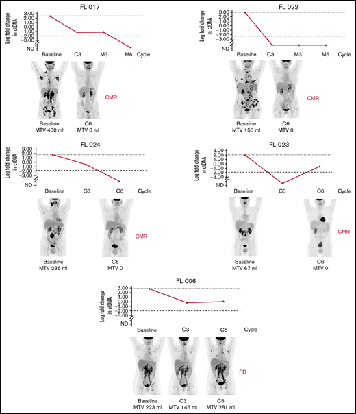 Correlation of clonal evolution and MTV in 5 patients with both data available. Only patient 006 had evidence of progressive disease by PET. C, cycle; CMR, complete metabolic remission; EoM, end of maintenance; M, maintenance; PD, progressive disease.