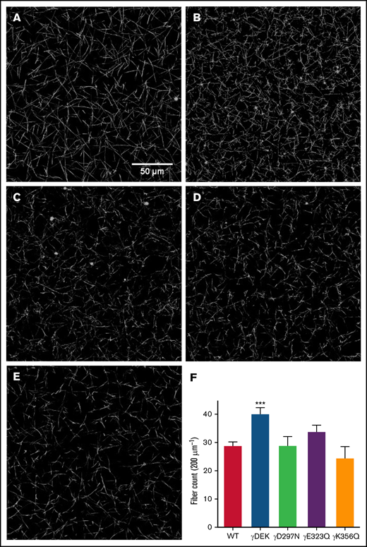 Density differences of WT and fibrinogen variant fibrin clots involved in extended knob-hole interactions. Fibrin clots were allowed to form for 1 hour and imaged using laser scanning confocal microscopy (A: WT, B: γDEK, C: γD297N, D: γE323Q, E: γK356Q). Fiber count per 200 µm was quantified (F). Variant γDEK (B, F) was denser than WT (A, F). Mean ± SD, N = 4 (WT), N = 3 (all variants). ***P < .001 for variants compared with WT.