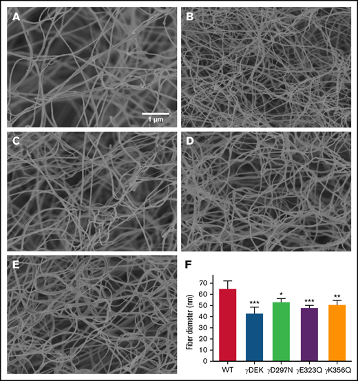 Recombinant fibrinogen variants γDEK, γD297N, γE323Q, and γK356Q affect fiber thickness. Micrographs were taken at ×20 000 magnification using a Hitachi SU8230 scanning electron microscope (A-E). Compared with WT (A), fibrin fibers of γDEK (B, F), γD297N (C, F), γE323Q (D, F), and γK356Q fibers (E, F) were thinner. Mean ± SD, N = 3 (WT, γDEK, γD297N), N = 4 (γK356Q), N = 5 (γE323Q). *P < .05; **P < .01; ***P < .001 compared with WT.