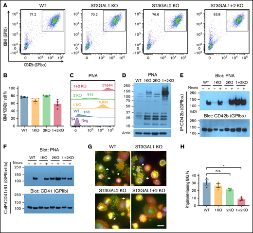Loss of ST3GAL1 and ST3GAL2 disrupts O-glycan sialylation of major surface glycoproteins on MKs and impairs proplatelet formation. (A) Flow cytometric analysis showed production of CD41+/CD42b+ MKs from different iPSC lines. (B) Quantitated yield of CD41+/CD42b+ MKs from different iPSC lines. Values represent the means plus or minus SEM from 4 independent experiments. No significance was found by 1-way ANOVA with Dunnett’s test compared with WT cells. (C) Flowcytometric analysis of PNA binding to iPSC-derived MKs. Numbers indicate median fluorescence intensities. (D) PNA blot revealed a subset of glycoprotein substrates for ST3GAL1 and ST3GAL2 in lysates from MKs. (E) Immunoprecipitation with anti-GPIbα monoclonal antibody AP1 from lysates of iPSC-derived MKs, followed by SDS-PAGE and immunoblot with either PNA or rabbit anti-GPIbα polyclonal antibody. Immunoprecipitated GPIbα from different cell lines was treated with neuraminidase for complete exposure of PNA-reactive epitopes as positive controls. (F) Coimmunoprecipitation of GPIIb-IIIa complex with anti-GPIIIa monoclonal antibody AP3 from lysates of iPSC-derived MKs, followed by SDS-PAGE and immunoblot with either PNA or rabbit anti-GPIIb polyclonal antibody. (G) Immunofluorescence staining of iPSC-derived MKs cultured on fibrinogen-coated glass slides. The cells were labeled with phalloidin (red), anti-GPIbα antibody (green), and 4′,6-diamidino-2-phenylindole (blue). Scale bar, 20 μm. White arrows indicate proplatelet-forming MKs. (H) Quantitated percentage of proplatelet-forming MKs from each cell line. Values represent the means plus or minus SEM from 3 independent experiments. *P < .05 by 1-way ANOVA with Dunnett’s test compared with WT cells. n.s., not significant; SDS-PAGE, SDS-polyacrylamide gel electrophoresis.