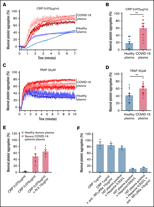 Effect of plasma from patients with severe COVID-19 on washed healthy platelet aggregation response. Washed platelets from 6 healthy donors were resuspended in plasma from 11 to 15 patients with severe COVID-19 or 9 healthy donors. The platelet aggregation response (% of maximal platelet aggregation) was then assessed by light transmission aggregometry in response to low doses of CRP (0.075 µg/mL) (A-B) and TRAP (25 µM) (C-D) for 10 minutes. Representative aggregation traces are shown (A, C) as well as the quantification of maximal platelet aggregation response (B, D). Results are mean ± SEM; each circle represents an individual plasma. **P < .01 according to the nonparametric Mann-Whitney test. The potential impact of FcγRIIA receptor on the potentiation of plasma of patients with severe COVID-19 on CRP-induced platelet aggregation was assessed by using the IV.3 neutralizing antibody (E). As a positive control of the IV.3 antibody efficiency, 3 sera from patients with heparin-induced thrombocytopenia (HIT) were used in the presence of heparin (0.5 IU/mL) to induce healthy platelet aggregation via FcγRIIA. The specificity of the reaction was assessed by addition of a large excess of heparin to impair platelet aggregation induced by HIT sera (F).