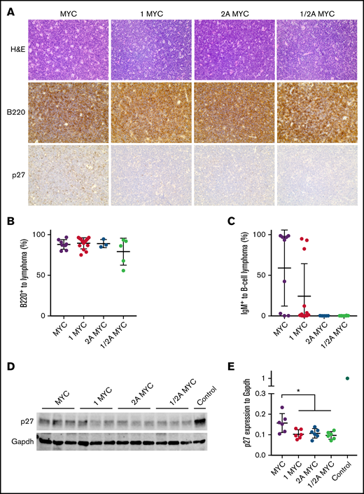 LMP1/λ-MYC B-cell lymphomas have decreased p27 expression. (A) Representative immunohistochemical analysis of lymph node tumors from 3 to 6 mice of each genotype. Tumors were isolated from the cervical area in LMP1/λ-MYC, LMP2A/λ-MYC, and LMP1/LMP2A/λ-MYC mice and from cervical or abdominal locations in λ-MYC mice. Formalin-fixed samples were stained with hematoxylin and eosin, B220, and p27kip1 using an EVOS XL microscope with 40× magnification. (B) Percentages of B-cell lymphoma cells to total prepared tumor cells were calculated by flow cytometry staining for B220. Isolated lymphoma cells were prepared using a nylon mesh. (C) Percentages of IgM+ cells in total B220+ lymphoma cells are indicated. (D) Representative immunoblots of p27kip1 expression in purified tumor cells. Prepared tumor samples from LMP2A/λ-MYC/Cks1−/− in which p27kip levels were similar to WT splenic B cells were used as a control. (E) P27kip1 expression was normalized to Gapdh. Dot plot graphs represent the mean ± standard deviation. P values were calculated by unpaired t test, *P < .05.