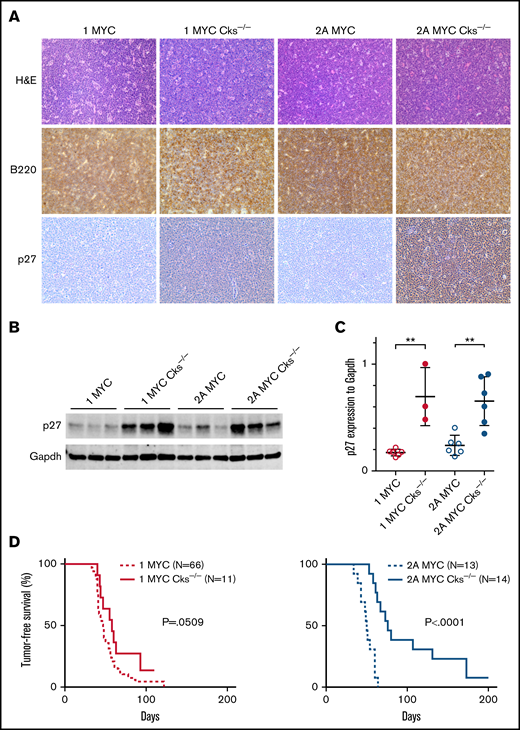 Cks1 knockout restores p27kip expression but does not change tumor onset in LMP1/λ-MYC mice. (A) Representative immunohistochemical analysis of lymph node tumors from 3 to 6 mice of each genotype stained with hematoxylin and eosin, B220, and p27kip1 using an EVOS XL microscope with 40× magnification. All tumors were isolated from the cervical area. (B) Representative immunoblots of p27kip1 expression in tumor cells. We previously reported that the p27kip levels in LMP2A/λ-MYC/Cks1−/− tumors were similar to WT splenic B cells.33 (C) P27kip1 expression was normalized to Gapdh. Dot plot graphs represent the mean ± standard deviation. P values were calculated by unpaired t test, **P < .01. (D) Kaplan-Meier curves indicate tumor-free survival percentages with or without Cks1 knockout in the background of LMP1/λ-MYC or LMP2A/λ-MYC mice.