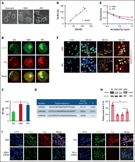 CD44 from NB4 and APL cells ligates with fibrinogen (Fbg). (A) Leukemia cells and neutrophils were mixed with Fbg (1 mg/mL) and thrombin (1 U/mL) for 2 hours. Dense fibrin networks formed among NB4 and APL cells (arrows). Almost no fibrin was located on the membrane of neutrophils. Scale bar, 10 µm. (B) Representative immunofluorescence images from direct staining of CD44 (green) and Fbg (red). Scale bar, 10 µm. (C) The MFI of Fbg in panel B. (D) The MFI of Fbg deposited on the membrane of NB4/APL cells was correlated with the MFI of CD44. (E) Competition assays. A nonlabeled Fbg was added to the mixture at different concentrations. The fluorescence of Fbg was detected by using flow cytometry. (F) APL/NB4 cells were incubated with Fbg, and images were obtained at the indicated time points. Fbg deposited on the surface of leukemic cells (arrowheads). Thrombin was added 60 minutes after leukemic cells were mixed with Fbg, and the mixture was treated as described in “Methods.” Leukemia cells were wrapped by fibrin networks (arrows). Scale bar, 10 µm. (G-H) The target sequence and the percent knockdown are shown as follows. The expression of CD44 was measured by western blotting, and the mean gray value was measured by using ImageJ. (I) NB4 cells/APL blasts with/without CD44 knockdown were cultured with Fbg for 1 hour. Fluorescence images showed decreased Fbg deposition on the CD44 knockdown cells. Scale bar, 20 µm. *P < .05, **P < .01. AU, arbitrary units; Ctrl, control; DAPI, 4′,6-diamidino-2-phenylindole.