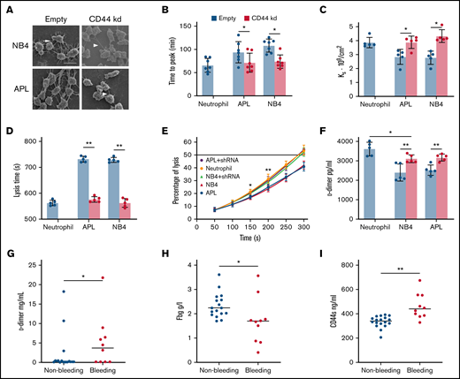 The effect of CD44 from APL cells on fibrin clot structure and properties. (A) APL/NB4 cells treated with empty vector and CD44 knockdown (kd) shRNA were incubated with fibrinogen (Fbg) and thrombin, leukemic cells were surrounded by thick fibrin networks (arrow), and CD44 kd cells exhibited thin fibers (arrowheads). Scale bar, 10 µm. (B) Clotting was induced by incubating leukemic cells with PPP. The time to the plateau of the clot was monitored according to turbidity. (C) The permeability of these clots was measured as described in “Methods.” (D-E) Clot lysis assays were performed in the presence of 1 nM tissue-type plasminogen activator. The time was recorded according to clot turbidity at 405 nm. (F) Five minutes after the clot assays began, the level of d-dimer was measured. (G-I) The levels of d-dimer, Fbg, and soluble CD44 (CD44s) in patient plasma were measured. *P < 0.05, **P <0 .01. Each image in panel A was from at least 3 experiments. *P < .05 vs previous data in the APL group, **P < .01 vs previous data in the NB4 group in panel E. Each value was from at least 5 experiments and is shown as the mean ± standard deviation.