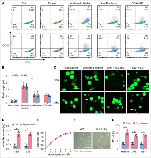 APL cells bind activated platelets through CD44. (A) Representative examples of leukemic cells (NB4 cells, upper; APL cells, the next row) interacting with resting/activated platelets. Activated platelet-bound cells were assessed by myeloperoxidase (MPO) (leukemic cells) and CD62P (activated platelets) staining. (B) The number of leukemia cell–platelet complexes from the data in panel A. (C) NB4 and APL cells (green) were mixed with resting and activated platelets (red) with/without anti–P-selectin antibody or CD44 knockdown (CD44 KD), respectively. The overlap indicates leukemic cell adherence to platelets (arrowheads). Scale bar, 20 µm. (D) A total of 1 × 104 leukemic cells, with or without surrounding fibrinogen (Fbg), were mixed with isolated platelets (2 × 106) for 45 minutes. The formation of FXa was measured as described in “Methods.” (E) APL cells coated with Fbg at various concentrations were mixed with isolated platelets, and the formation of FXa was measured. (F) Representative images of platelets with Fbg treatment. PS exposure was shown by lactadherin staining. Scale bar, 10 µm. (G) Platelets were treated with Fbg or Fbg-coated APL/NB4 cells, and PS exposure was measured by using flow cytometry. **P < .01, *P < .05, #P < .05 vs the data in the remaining platelet group in panel B. *P < .05 in panels D and G. Ctrl, control.