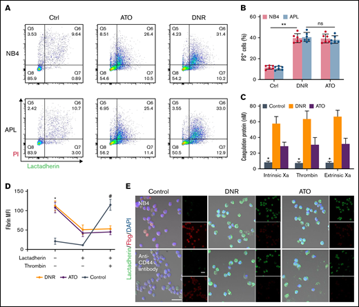 CD44 and PS exposure on the surface of leukemic cells contributes to the in situ deposition of fibrin. (A) Flow cytometry was used to quantify apoptotic cells stained with lactadherin after treatment with chemotherapy drugs. (B) The percentage of apoptotic leukemic cells. (C) A total of 1 × 106 target APL cells were incubated with coagulation reaction substrates, and the production of thrombin, intrinsic FXa, and extrinsic FXa was measured by using a microplate reader. (D) Leukemia cells with various treatments were incubated with fibrinogen and coagulation reaction substrates in the presence of lactadherin or thrombin. Fibrin absorption was evaluated by using a microplate reader. (E) Leukemic cells treated as described above were stained with lactadherin (green), fibrinogen (red), and 4′,6-diamidino-2-phenylindole (DAPI; blue). Scale bars, 20 µm. Each image was from 5 experiments. **P < .01 in panel B. *P < .05 vs the data in the DNR group in panel C. *P < .05 vs the control, #P < .05 vs the DNR group in panel D. Each value was from at least 3 experiments and is shown as the mean ± standard deviation. Ctrl, control; ns, not significant; PI, propidium iodide.