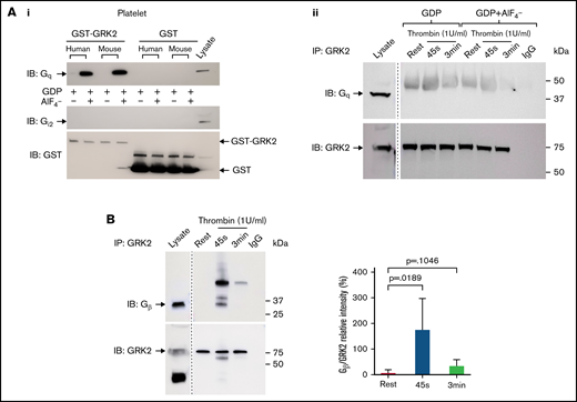 Gβ interacts with endogenous GRK2 in platelets ex vivo but Gqα does not. (Ai) GST-GRK2 was immunoprecipitated from human or mouse platelets, and samples were probed for Gqα or Giα2. Glutathione S-transferase (GST) reprobe indicated the equal loading. n = 2. (Aii) Human platelet lysate from resting or 1 U/mL thrombin-stimulated platelets in the presence or absence of GDP+AlF4– were subjected to immunoprecipitation of GRK2 and probed for Gq. n = 3. (B) GRK2 from resting and thrombin-stimulated (1 U/mL) human platelet lysate was immunoprecipitated with the specific mouse anti-GRK2 antibody and probed for Gβ. GRK2 was reprobed with an anti-GRK2 antibody. n = 6. A marker line was excised as indicated by the vertical line.