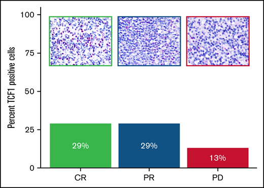 Expression of TCF1 marker in THRLBCL patients treated with pembrolizumab. Bar chart histograms comparing the percentage of cells positive for TCF1 protein by IHC in r/r THRLBCL treated with pembrolizumab. Patients with clinical benefit after pembrolizumab are indicated in green (CR) and blue (PR); the early nonresponder is depicted in purple. Upper panels: representative areas demonstrating the different content of TCF1 immunohistochemical staining (red) in the 3 samples (Olympus BX53 light microscope, Olympus DP71 camera, original magnification 60×).