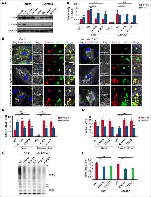 E1841K mutant influences the peripheral distribution and subsequent exocytosis of Rab27a-positive WPBs due to decreased phosphorylation of NMII-A at S1943. (Ai) Western blots of p-S1943 and total NMII-A in HUVECs expressing SCR or shNMII-A that were rescued by flag-tagged NMII-A WT, E1841K and S1943A mutant. (Aii) Ratio of p-S1943 and total NMII-A to loading control α-tubulin of Ai (***P < .001). (B) Immunostaining of VWF (green), flag (white), and Rab27a (red) in HUVECs expressing flag-tagged NMII-A WT, E1841K, and S1943A mutant. The magnified panels showed the peripheral region (a) and the perinuclear region (b). The peripheral region was defined as the region whose distance to nuclear was >10 μm. Scale bars represent 5 μm. (C) Quantitative analysis of the number of Rab27a-positive WPBs in perinuclear and peripheral regions. (D) Quantitative analysis of the number of Rab27a-negative and Rab27a-positive WPBs (n = 16; **P < .01; ***P < .001). (E) VWF multimer distribution of confluent HUVEC medium after 15 minutes of forskolin stimulation. (F) Ratios of high to low molecular weight of VWF multimers in (C) (**P < .01).