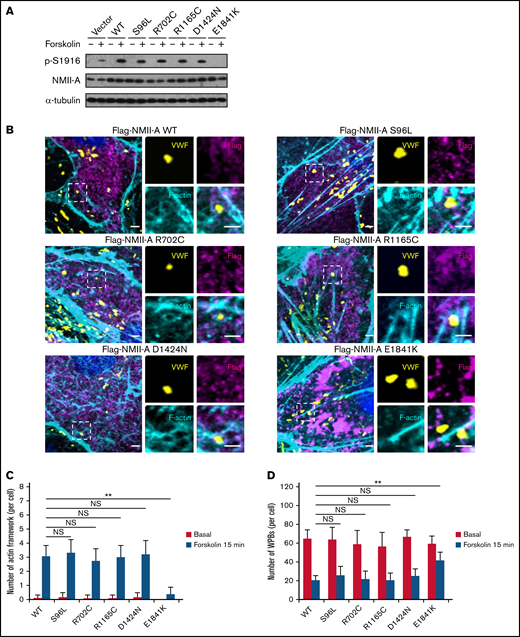E1841K mutant decreases the number of cAMP-induced formation of actin framework around WPBs due to decreased phosphorylation of NMII-A at S1916. (A) Western blotting of p-S1916 and total NMII-A in HUVECs expressing flag-tagged NMII-A WT and 5 MYH9-RD mutants stimulated with forskolin for 15 minutes. (B) Immunostaining of VWF (yellow), flag (magenta), and F-actin (cyan) in HUVECs expressing flag-tagged NMII-A WT and 5 MYH9-RD mutants. Scale bars represent 2 μm. (C) Quantitative analysis of the number of actin framework-coupled WPBs per cell. (D) The total number of WPBs per cell (n = 16; NS > 0.05; **P < .01). NS, not significant.