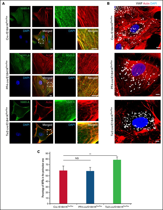 Abnormal WPB distribution in primary ECs derived from endothelium-specific E1841K mutant mice. (A) Immunostaining of NMII-A (green) and actin (red) in BECs from cre-, PF4-cre, and Tie2-cre/E1841Kflox/flox mice. Scale bars represent 5 μm. (B) Immunostaining of VWF (white) and actin (red) in these BECs. (C) Percentage of WPBs in the perinuclear area (n = 16; NS > 0.05; **P < .01). NS, not significant.