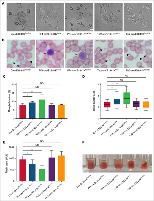 Endothelium-specific E1841K mutant mice show normal platelets while megakaryocyte-specific E1841K mutant mice show platelet abnormalities characteristic of MYH9-RD. (A) Live-cell images of proplatelet formation from isolated megakaryocytes. Scale bars represent 20 μm. (B) Wright-Giemsa–stained blood smears from cre-, Tie2-cre/E1841Kflox/+, and Tie2-cre/E1841Kflox/flox mice show normal size platelets (black arrows), while blood smears from PF4-cre/E1841Kflox/+ and PF4-cre/E1841Kflox/flox mice show abnormally large platelets (red arrow). (C) Mean platelet volumes of circulating platelets. Results represent mean ± SD. MPVs of cre-/E1841Kflox/flox: 7.86 ± 1.09 fL (n = 16); PF4-cre/E1841Kflox/+: 9.44 ± 0.58 fL (n = 16); PF4-cre/E1841Kflox/flox: 11.18 ± 3.14 fL (n = 16); Tie2-cre/E1841Kflox/+: 7.88 ± 0.94 fL (n = 16); and Tie2-cre/E1841Kflox/flox: 8.04 ± 0.22 fL (n = 16) (NS > 0.05; *P < .05; **P < .01). (D) Platelet diameters measured from peripheral blood smears. Platelet diameters (mean ± SD) of cre-/E1841Kflox/flox: 2.45 ± 0.58 μm (n = 150); PF4-cre/E1841Kflox/+: 3.02 ± 0.67 μm (n = 150); PF4-cre/E1841Kflox/flox: 3.66 ± 1.14 μm (n = 150); Tie2-cre/E1841Kflox/+: 2.59 ± 0.57 μm (n = 150); and Tie2-cre/E1841Kflox/flox: 2.51 ± 0.59 μm (n = 150) (NS > 0.05; *P < .05; **P < .01). (E) Circulating platelet counts from peripheral blood. Results represent mean ± SD. Circulating platelet counts of cre-/E1841Kflox/flox: 954.75 ± 152.63 K/μL (n = 16); PF4-cre/E1841Kflox/+: 764.12 ± 175.43 K/μL (n = 16); PF4-cre/E1841Kflox/flox: 522.19 ± 154.08 K/μL (n = 16); Tie2-cre/E1841Kflox/+: 1029.56 ± 322.01 K/μL (n = 16); and Tie2-cre/E1841Kflox/flox: 1124.44 ± 176.18 K/μL (n = 16) (NS > 0.05; *P < .05; **P < .01). (F) Clot retraction test 5 hours after stimulation (n = 5 per genotype). NS, not significant.