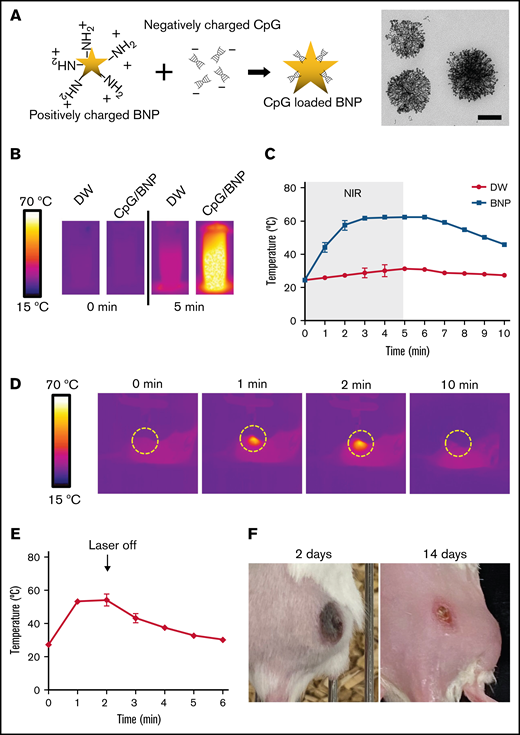 Synthesis and characterization of BNPs with CpG deoxynucleotide complex (CpG/BNP). (A) Schematic of coating positively charged BNPs with negatively charged CpG deoxynucleotides. On the right is transmission electron microscopic image of BNP. Scale bar, 100 nm. (B) Photothermal moiety of CpG/BNP. CpG/BNP (4 mg/50 μL) was irradiated for 5 minutes with near-infrared (NIR) laser (808 nm) with 2-W output (361.2 mW/cm2). Temperature was monitored by NIR camera. (C) Temperature tracing of deionized water (DW) and BNP during and after 5 minutes of laser exposure. (D) In vivo thermal image of PTT of single flank A20 lymphoma tumor on BALB/c mouse. After injection of 1 mg of CpG/BNP to right flank, mice were irradiated for 2 minutes with NIR laser (808 nm) with 2-W output (361.2 mW/cm2). (E) Temperature curve of lymphoma tumor during and after PTT. (F) Photothermal ablation–mediated necrosis of mice skin. Scar notable 2 days after PTT that resolved after 14 days with no recurrence of the tumor.