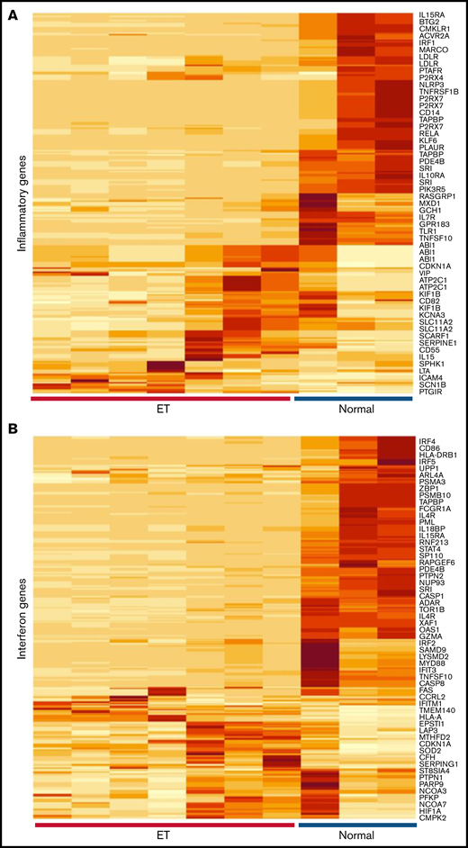 Characterization of inflammatory gene profiles in platelets. (A-B) RNA-Seq data from ET (N = 7) or healthy control (N = 3) platelets35 were filtered by using Hallmark40 inflammatory response (A, n = 200) or IFN response (B, n = 224) genes, followed by unsupervised hierarchical clustering by Euclidean distance (differentially expressed genes are shown). Note clear segregation of phenotypes in both panels. (C) In silico expression studies of aggregated IFN response genes (n = 224) by phenotype (normal, n = 3; ET, n = 7); data are expressed as mean ± standard error of the mean (SEM) of reads per kilobase per million (RPKM) normalized and scaled to mean 0. (D) Platelet quantitative polymerase chain reaction of select IRGs or platelet-specific genes (VWF and PF4) from a secondary cohort of healthy controls (n = 4) or ET (n = 8), expressed as mean ± SEM normalized to actin; box plots (panels C-D) represent the within-group interquartile range encompassing 50% of the values, whereas the 95% CIs and outliers are depicted. The horizontal bar within each box represents the group median. P values (t test) are shown. NS, not significant.