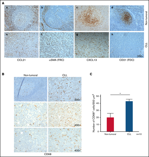 Disorganization of FRC/FDC networks and increase of CD68+ macrophages in CLL lymph nodes. (A) Representative images from nontumoral (panels a-d) and CLL (panels e-h) lymph node tissue sections. Immunohistochemical staining was used on samples (anti-CCL21 and anti-αSMA or anti-CXCL13 and anti-CD21 antibodies), representative of FRC and FDC (original magnification ×200). (B) Representative images from nontumoral (left panels) and CLL (right panels) lymph node tissue sections stained with anti-CD68 antibody (original magnification ×200 and ×400, respectively). (C) Quantification of CD68+ cells per 550 μm2 section in nontumoral (n = 10) and CLL lymph nodes (n = 10); statistical analysis was carried out by Student t-test (*P < .005). Images were acquired using a DFC 300 FX Leica microscope with a ×10 objective.