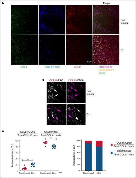 CCL21 is produced by FRCs and CD68+ cells. (A) Representative images from nontumoral (upper panels) and CLL (lower panels) lymph node sections stained with anti-CD68 (green), anti-ER-TR7 (blue), or anti-CCL21 (red) antibodies (objective ×63; scale bar represents 12 μm) and merged images in pink (FRC/CCL21) or yellow (CD68/CCL21). Images were acquired using a DMI6000 Leica Spinning Disk microscope with a ×40 1.25NA objective (Leica Microsystems, Wetzlar, Germany) and a Photometrics Coolsnap HQ CCD, driven by Metamorph software (Molecular Devices, Sunnyvale, CA) at the Imaging Facility of Cochin Institute, Paris, France. (B) Masks created from the images in panel A by combining FRC and CCL21 signals or CD68 and CCL21 signals. Pixels are white when both channels are positive and pink when CCL21 is alone. (C) Graph comparing the ratios between colocalized CCL21/CD68 or CCL21/FRC pixels and the total number of CCL21+ cells in nontumoral and CLL samples. Measure of the colocalization was obtained by computing the total number of positive pixels. Means were compared in a Student t-test (**P = .0026; n = 8).