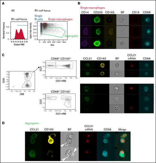 CD68+ NLCs produce CCL21. (A) Assay outline and gating strategy applied to identify single cells and aggregates. Cells in camera focus were selected from all events on the basis of gradient RMS of the bright field image. Single B cells, macrophages, and cellular aggregates were identified by plotting “area” vs “aspect ratio” in which events with higher aspect ratio are assigned to single cells while those with lower aspect ratio are aggregates. (B) Image gallery of single macrophages showing different subpopulations based on CD14 (purple), CD206 (green), CD163 (yellow), CD19 (red), and CD68 (cyan) fluorescent signals as well as Brightfield (BF). (C) Detection of CCL21 mRNA and protein in CD68+ CD163+ or CD68+ CD163− subpopulations. Galleries show CCL21 protein (green), CD163 (yellow), CCL21 mRNA (red), and CD68 (cyan) fluorescent signals as well as Brightfield (BF). (D) Image gallery of aggregates of macrophages and B cells showing CCL21 (green), CD163 (yellow), CCL21 mRNA (red), and CD68 (cyan) fluorescent signals as well as Brightfield (BF). Arrows show B cells present in the aggregates. Merged images show that B cells are negative for CCL21 and CCL21 mRNA signals. All the experiments were performed in permeabilized cells after brefeldin (BFA) treatment.
