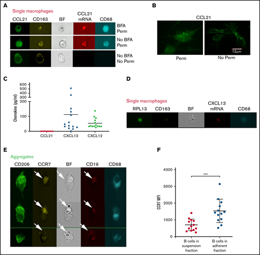 CCL21 is retained on cell membrane and not detected in the supernatant. (A) Image galleries of single macrophages (as defined in panel 3A) showing CCL21 (green), CD163 (yellow), CCL21 mRNA (red), and CD68 (cyan) fluorescent signals and Brightfield (BF) in permeabilized (upper and middle) and nonpermeabilized (lower) conditions in presence (upper) or absence (middle and lower) of BFA treatment. (B) Confocal images of adherent CD68+ cells stained with anti-CCL21 Ab in permeabilized (left) or nonpermeabilized (right) conditions (objective ×63; scale bar represents 12 μm). (C) CCL21, CXCL13, and CXCL12 protein levels secreted by adherent NLCs after 14 days of culture detected by Luminex technology. Dots represent individual protein levels from 14 patients with CLL. (D) Detection of CXCL13 mRNA in single macrophages. Image galleries of single macrophages showing RPL13 mRNA (green), CD163 (yellow), CXCL13 mRNA (red), and CD68 (cyan) fluorescent signals and Brightfield (BF). RPL13 mRNA of ribosomal protein L13A was used as housekeeping control. (E) Image gallery of aggregates showing macrophages and B cells based on CD206 (green) and CD68 (cyan) or CCR7 (yellow) and CD19 (red) fluorescent signals, respectively, as well as Brightfield (BF) in permeabilized conditions. Arrows show B cells present in the aggregates. (F) Graph shows the CCR7 MFI (Mean Fluorescence Intensity) values detected on B cells in suspension or remaining in the adherent fraction after 14 days of culture.