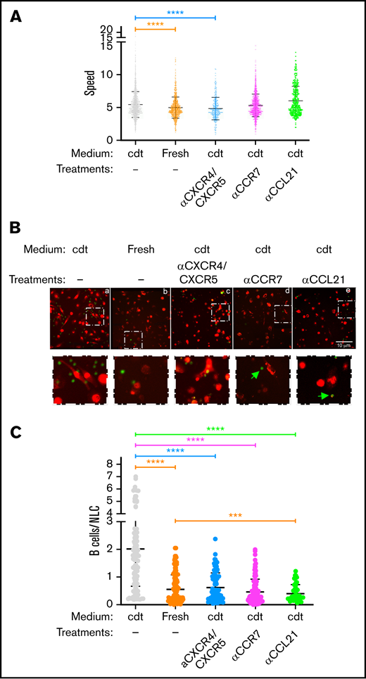 Chemokines produced by NLCs impact B cell motility. (A) Graph comparing the mean speed of B cells loaded on NLC monolayers in 14-day culture-conditioned medium (cdt) or fresh medium. B cells were left untreated or incubated with anti-CCR7 (10 μg/mL), anti-CXCR4 (30 μg/mL), and anti-CXCR5 antibodies (20 μg/mL) before loading. CD68+ NLCs were incubated or not with anti-CCL21 antibody (4 μg/mL) before addition of untreated B cells. Motility was analyzed using Trackmate in ImageJ software. Only displacement lengths >10 μm were included in the analysis (n = 12). (B) Representative images of interactions between CLL B cells (green) and CD68+ NLCs (red) after 4 hours of coculture in conditions identical to panel A and vigorous washing (objective ×20; scale bar represents 10 μm). The areas in the white dotted boxes in the upper panel are ×3.5 zoomed in the lower panels to show B/NLC interactions. Green arrows show noninteracting B cells. (C) Graph comparing the ratios of colocalized B cells/NLCs detected in the different conditions. Postacquisition data analysis of images in panel B was performed using ImageJ software. To quantify B cells in contact with NLCs, a threshold was applied to obtain a mask of NLCs, and the number of B cells present in this mask was evaluated using the “analyze particles” tool and represented in the graph as number of B cells per NLC. Statistical analysis was carried out by Student t-test (***P < .001; ****P < .0001; n = 12).