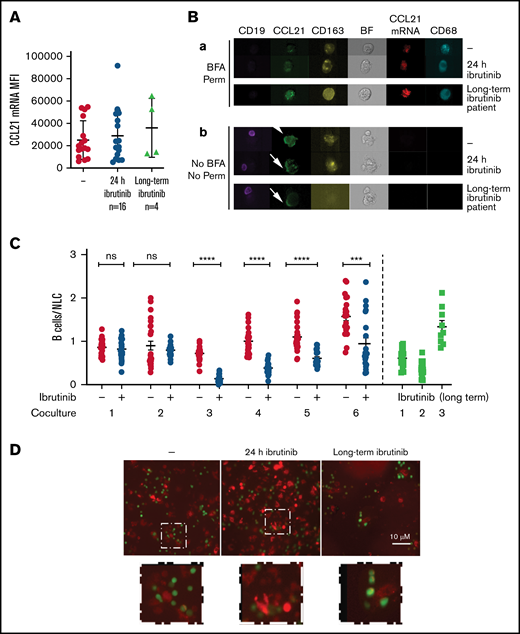 Ibrutinib impacts B cells/NLC interaction. (A) Graph shows the CCL21mRNA MFI values detected in NLC cells exposed or not to ibrutinib 24 hours before analysis (P = ns; n = 16) or in NLCs derived from patients treated with ibrutinib (n = 4). (B) Image galleries of single macrophages or aggregates (as defined in Figure 3A) exposed or not to ibrutinib for 24 hours (upper panels) or derived from patients treated with ibrutinib (lower panels) showing CD19 (purple), CCL21 (green), CD163 (yellow), CCL21 mRNA (red), and CD68 (cyan) fluorescent signals and Brightfield (BF) in permeabilized conditions and in presence of BFA (a) or nonpermeabilized conditions and no BFA treatment (b). (C) Graph comparing the ratios of colocalized B cells/NLCs after 4 hours of coculture exposed (+) or not (−) to ibrutinib for 24 hours (n = 6) or in cocultures derived from patients treated long-term with ibrutinib (n = 3). Statistical analysis was carried out by Student t-test (***P < .001; ****P < .0001) comparing untreated and treated samples. (D) Representative images of interactions between CLL B cells (green) and CD68+ NLCs (red) after 4 hours of coculture priorly treated or not with ibrutinib (24 hours) or in cocultures derived from patients treated with ibrutinib (objective ×10; scale bar represents 10 μm). The areas in the white dotted boxes in the upper panel are ×2.5 zoomed in the lower panels to show B cell/NLC interactions.