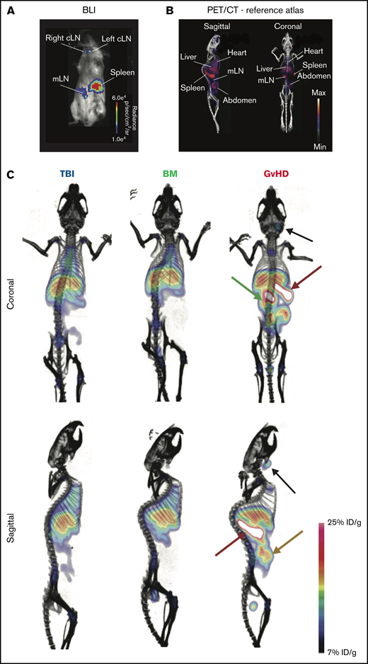 89Zr-DFO-ICOS mAb immunoPET imaging of acute GvHD. (A) Representative BLI of a mouse with acute GvHD at day 4 post-HCT. (B) Reference atlas indicating the location of key clearance and lymphoid organs as well as GvHD target tissues. (C) Representative 89Zr-DFO-ICOS mAb PET/CT images acquired 48 hours after tracer administration at day 4 after HCT in TBI control (n = 5), bone marrow control (n = 7), or GvHD (n = 11) mice. Key organs, namely spleen (red arrow), cervical lymph node (cLN) (black arrow), mLN (green arrow), and intestine (yellow arrow), are highlighted. Images are representative of 2 independent experiments. %ID/g, percent injected dose per gram.