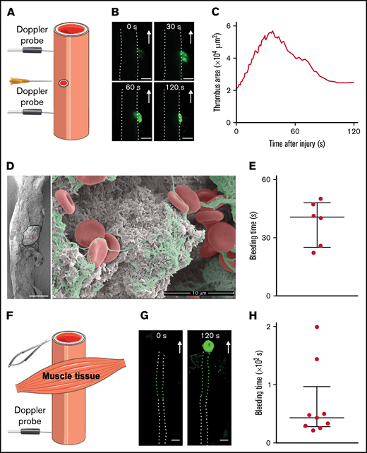 Two novel models of hemostasis in mice. (A) Schema of the murine vessel puncture model with 2 laser Doppler probes. (B-E) Thrombus formation was induced by needle puncture of the left common carotid artery of wild-type mice. (B) Representative fluorescence images of the thrombus (platelets labeled with DIOC6 in green) at the indicated time points after injury with a 25-gauge needle. Scale bar: 250 μm. The arrows represent the direction of blood flow, and the dotted lines represent the borders of the vessel. (C) The curve shows the area of the hemostatic thrombus as a function of the time after injury. (D) Representative scanning electron microscopy images of the external thrombus 3 minutes after vessel puncture. The black solid line represents the border of the thrombus. Scale bar: 250 μm (left), 10 μm (right). The thrombus is composed of tightly packed platelets, fibrous strands whose ultrastructure resembles fibrin, and RBCs, colored on the enlarged image of the area in the red square in gray, green, and red, respectively. (E) The dot plot shows the bleeding times of the wounds after vessel puncture. Data are presented as the mean ± the standard error of the mean (SEM) and individual symbols represent individual mice. (F) Schema of the murine vessel transection model with a laser Doppler probe. (G-H) Thrombus formation was induced by transection of the spermatic artery of wild-type mice with microscissors. (G) Representative fluorescence images of the thrombus (platelets labeled with DIOC6 in green) at the indicated time points after injury. Scale bar: 250 μm. The arrows indicate the direction of blood flow. The white dotted lines represent the borders of the exposed vessel, and the green dotted lines represent the borders of the vessel under muscle tissue. (H) The dot plot shows the bleeding times of the wounds after vessel transection. Data are presented as the mean ± SEM, and individual symbols represent individual mice.
