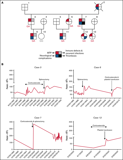 Pedigree of the family and platelet responses to therapeutic approaches. (A) Family pedigree and presence of SRC-RT resulting from Src p.E527K gain-of-function mutation. The upper left quarter burgundy shading in symbols indicates individuals with macrothrombocytopenia (MTP), the lower left quarter blue shading denotes neurological complications, the upper right quarter gray shading indicates immune defects (other than ITP) and recurrent infections, and the lower right quarter black shading indicates thrombosis. The deceased patient is indicated by a slash symbol. Patients carrying the heterozygous c.1579G>A variant in SRC are identified with GA genotype, and noncarriers with GG genotype. (B) Platelet responses to splenectomy and/or corticosteroids. The graphs show the timing of splenectomy and corticosteroid therapy and platelet count profiles of patients 3, 6, 7, and 12.