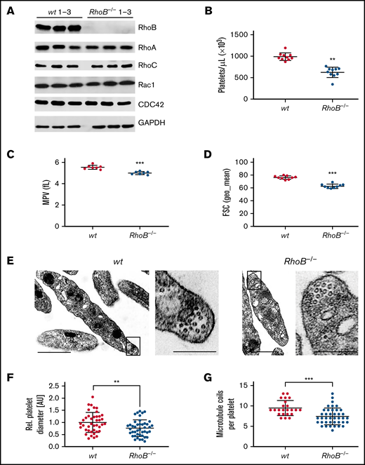 Loss of RhoB leads to microthrombocytopenia and alters microtubule organization in circulating platelets. (A) Blots of platelet lysates from wt and RhoB−/− mice immunoblotted for the indicated proteins. GAPDH was used as loading control (n = 3). (B) Platelet count assessed by flow cytometry. Each data point represents 1 mouse (n = 12). (C) Mean platelet volume measured with a Scilvet blood analyzer. Each data point represents 1 mouse (n = 7). (D) Platelet size assessed by forward scatter characteristics determined by flow cytometry. Each data point represents 1 mouse (n = 12). (E) Representative images of ultrastructural analysis of resting wt (left) and RhoB−/− (right) platelets by transmission electron microscopy (TEM). Scale bar overview, 1 µm; inset, 0.5 µm. (F) Quantification of platelet diameter (relation of platelet width to length) of RhoB−/− platelets relative to wt using TEM images described in panel E (wt n = 4; RhoB−/− n = 5). (G) Quantification of MT coils per platelet using TEM images described in panel E. MT number was determined by manual count of at least 5 imagesper genotype. Each data point represents 1 single platelet (wt n = 4; RhoB−/− n = 5). **P < .01; ***P < .001; Mann-Whitney U test, mean plus or minus SD. GAPDH, glyceraldehyde-3-phosphate dehydrogenase.