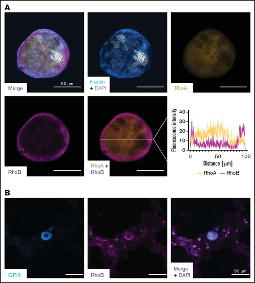 Staining of RhoA and RhoB in murine and human MKs. (A) Representative confocal images of in vitro–differentiated MKs 24 hours after bovine serum albumin gradient. The MKs were spun down to Poly-L-Lysine–coated glass slides and stained with Phallodin-Alexa488 (cyan), RhoA-Alexa546 (yellow), RhoB-Alexa647 (magenta), and DAPI to visualize the nucleus. Scale bar, 50 µm. Localization of RhoA and RhoB was analyzed by measuring the signal intensity on the white line (n = 2). (B) Representative confocal image of the human BM. Cryosections were stained with GPIX-FITC, RhoB-A546, and DAPI to visualize the nucleus. Scalebar, 50 µm. DAPI, 4′,6-diamidino-2-phenylindole.