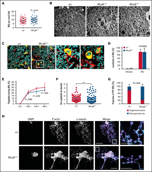 Decreased proplatelet tip size and impaired microtubule organization of RhoB−/− MKs in vitro. (A) Quantification of MK numbers in wt and RhoB−/− cryosections of the fluorescently labeled BM. At least 10 fluorescence images/mouse were analyzed using a confocal microscope. Each data point represents 1 MK (n = 7). Unpaired, 2-tailed t test, mean plus or minus SD. (B) Representative images of ultrastructural analysis of wt and RhoB−/− MKs in situ using TEM. Scale bar, 4 µm. (C) Representative confocal microscopy images of femur cryosections. The femora were processed using the Kawamoto method for cryosections. Sections were stained with fluorescently labeled anti-CD105 antibody to stain vessels (red), and fluorescently labeled anti-GPIX antibody to visualize MKs (yellow) and DAPI (blue). Scale bar in overview, 40 µm; in zoom, 5 µm. (D) Quantification of MK localization in wt and RhoB−/− BM in images shown in panel B. (E-H) Analysis of proplatelet formation of BM-derived RhoB−/− MKs. (E) Quantification of in vitro proplatelet formation at 18 hours, 24 hours, and 48 hours after enrichment by bovine serum albumin (BSA) gradient. Graph shows percentage of MKs that perform PPF (n = 3 mice per genotype). Multiple unpaired 2-tailed Student t test with Holm-Sidak correction for multiple comparisons, mean plus or minus SD. (F) Quantification of proplatelet tip diameter of wt and RhoB−/− MKs 24 hours after BSA gradient (normalized to wt, n = 2 mice per genotype). At least 11 MKs per mice were analyzed. Each data point represents 1 measured proplatelet tip (wt = 250; RhoB−/− = 494). ***P < .001; Mann-Whitney U test, mean plus or minus SD. (G) Quantification of MT organization in enriched wt and RhoB−/− MKs (n = 3 mice per genotype). At least 13 images/mouse were analyzed. Mann-Whitney U test, mean plus or minus SD. (H) Representative confocal images of in vitro–differentiated MKs 24 hours after BSA gradient. The proplatelets were spun down to Poly-L-Lysine–coated glass slides and stained with phalloidin-Atto647 (magenta), α-tubulin-Alexa488 (cyan), and DAPI to visualize the nucleus. (n = 5) Scale bar in overview, 40 µm; inset, 5 µm. DAPI, 4′,6-diamidino-2-phenylindole; PPF, proplatelet-forming; Intrasin., intrasinusoidal; SC, sinusoidal contact; TB, tubulin.