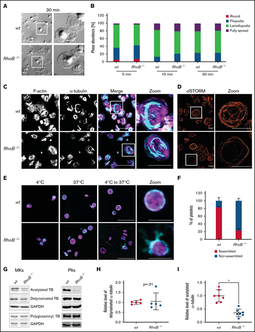 Impaired microtubule stability in RhoB−/− platelets. (A-B) Spreading and F-actin dynamics in RhoB−/− platelets. (A) Representative images of platelets spread on fibrinogen-coated cover slips in the presence of 0.01 U/mL thrombin for 30 minutes. (B) Quantification of platelet spreading on fibrinogen for 5, 10, and 15 minutes (n = 3). *P < .05; Mann-Whitney U test, mean plus or minus SD. (C-D) Analysis of spread platelets on fibrinogen by immunofluorescence confocal and superresolution (dSTORM) microscopy. (C) Representative confocal microscopy images of platelets spread on fibrinogen for 30 minutes with 0.01 U/mL thrombin, stained with phalloidin-Atto647 (magenta) and α-tubulin-Alexa488 (cyan), and imaged using a Leica TC SP8 confocal microscope. Scale bar in overview, 10 µm; scale bar in zoom, 5 µm (n = 4). (D) Representative dSTORM images of platelets spread on fibrinogen for 30 minutes, stained with α-tubulin-Alexa488 (red), and imaged using an in-house-made dSTORM microscope. Scale bar in overview and zoom, 5 µm (n = 2). (E-F) Analysis of cold-induced MT disassembly and reassembly of spread platelets in vitro. (E) Representative confocal immunofluorescence microscopy images of MT organization at 4°C and 37°C and a combination of disassembly at 4°C with following reassembly at 37°C in platelets. Platelets were stained with phalloidin-Atto647 (magenta) and α-tubulin-Alexa488 (cyan). Scale bar in overview, 10 µm; zoom, 3 µm (n = 3). (F) Quantification of MT organization in wt and RhoB−/− platelets after cold-induced MT disassembly and reassembly (4°C to 37°C). At least 5 images/mouse were analyzed, with minimum of 40 platelets per genotype (n = 3). *P < .05; Mann-Whitney U test, mean plus or minus SD. (G-I) Analysis of acetylation and detyrosination and polyglutaminylation of α-tubulin residues by immunoblotting. (G) Platelet and MK lysates of wt and RhoB−/− mice were immunoblotted for posttranslational modifications (PTM) of α-tubulin(acetylated α-tubulin, detyrosinated α-tubulin, and polyglutaminylated α-tubulin). (H-I) Quantification of PTM immunoblots. Each data point represents 1 mouse (acetylated α-tubulin n = 7; glutaminylated α-tubulin n = 5). *P < .05; Mann-Whitney U test, mean plus or minus SD. GAPDH, glyceraldehyde-3-phosphate dehydrogenase; TB, tubulin.