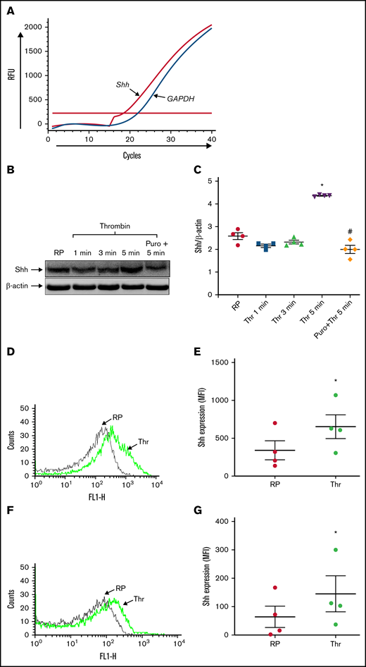 Platelets synthesize the Shh ligand upon agonist stimulation. (A) Amplification chart representing Cq of mRNAs in platelets as indicated. (B) Synthesis of Shh in platelets treated with thrombin (Thr) (0.5 U/mL) for varying time points. PVDF membrane developed for Shh was stripped and reprobed for β-actin. (C) Corresponding densitometric analysis normalized against β-actin. (D-E) Surface externalization of Shh in thrombin (1 U/mL)-induced platelets. (F-G) Shh exposure on EVs released from thrombin (1 U/mL)-stimulated platelets. RP, resting platelets. Data are represented as mean ± standard error of the mean of 3 to 5 independent experiments. *P < .05 as compared with resting platelets; #P < .05 as compared with thrombin-stimulated platelets.
