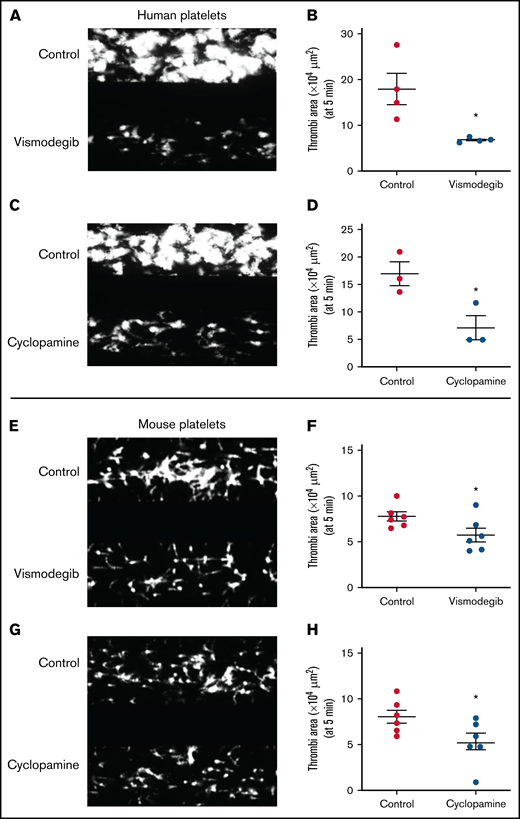 Platelet adhesion on immobilized collagen matrix under arterial shear is restricted by Shh antagonists. Washed human or murine platelets were perfused over an immobilized collagen matrix for 5 minutes in a microfluidic flow chamber at a shear rate of 1500s−1. (A,C,E,G) Representative images of platelet accumulation after 5 minutes of perfusion of human (A,C) or murine (E,G) platelets. Total thrombi area after 5 minutes of perfusion of human (B,D) or murine (F,H) platelets calculated as the average surface area covered by platelets in 5 representative fields. Figures are representative of ≥3 individual experiments (mean ± standard error of the mean). *P < .05 as compared with vehicle-treated control platelets.